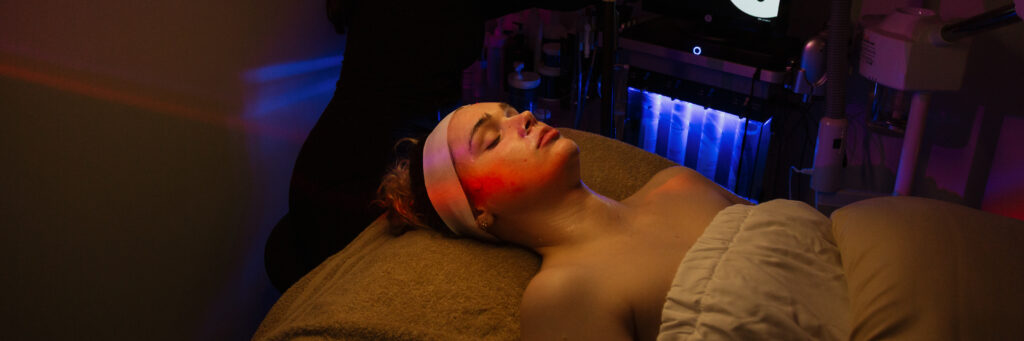 Patient receiving VirtueRF microneedling treatment at Prime MD Aesthetics & Wellness for skin tightening and rejuvenation.