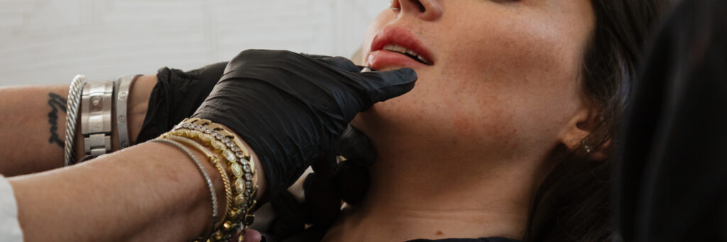 Provider administering Kybella injection under the chin at Prime MD Aesthetics & Wellness to contour and refine the jawline.