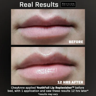 Revision YouthFull Lip Replenisher - Image 3